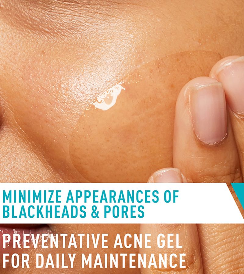 Acne Control Gel