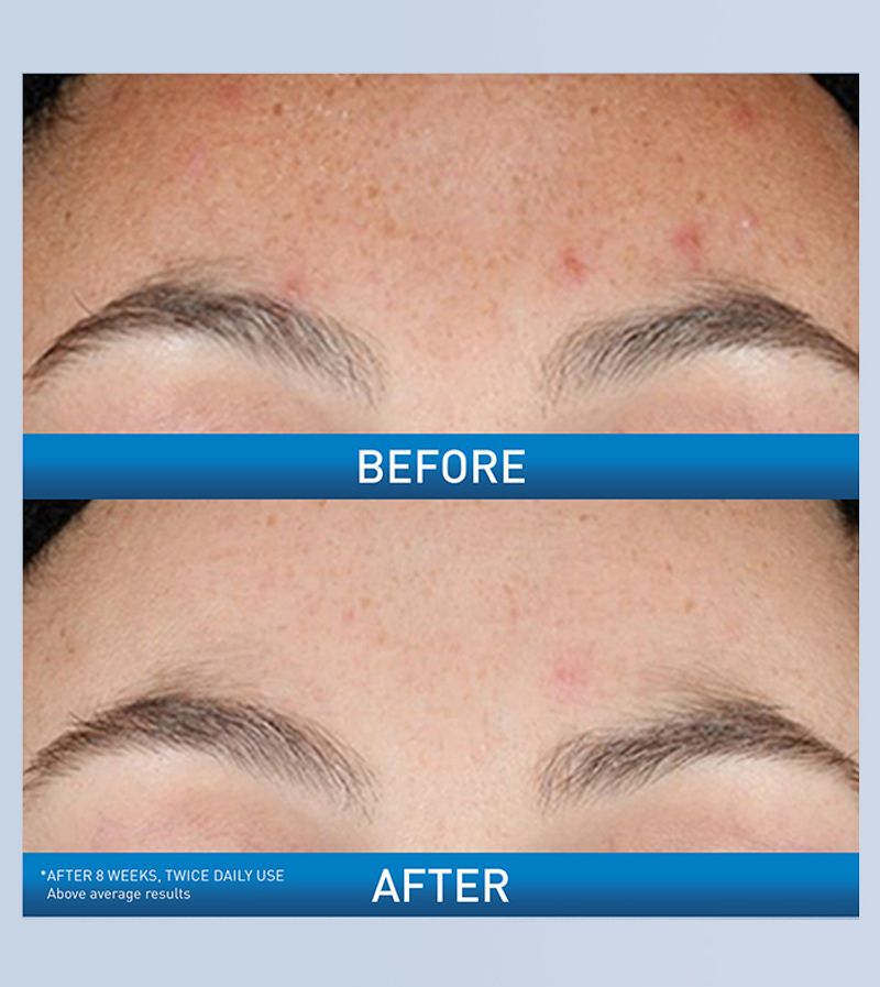 Resurfacing Retinol Serum